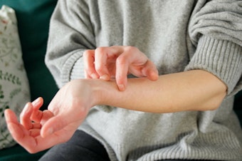 caption: New research finds that a common microbe may be directly causing itchiness on the skin it colonizes.